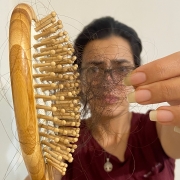 عوامل ریزش مو ریزش مو