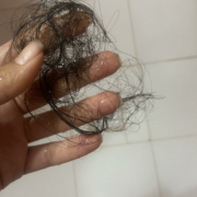 ریزش مو ریزش مو